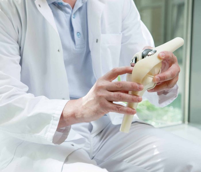 An orthopedic doctor holds up a skeletal model of a joint.